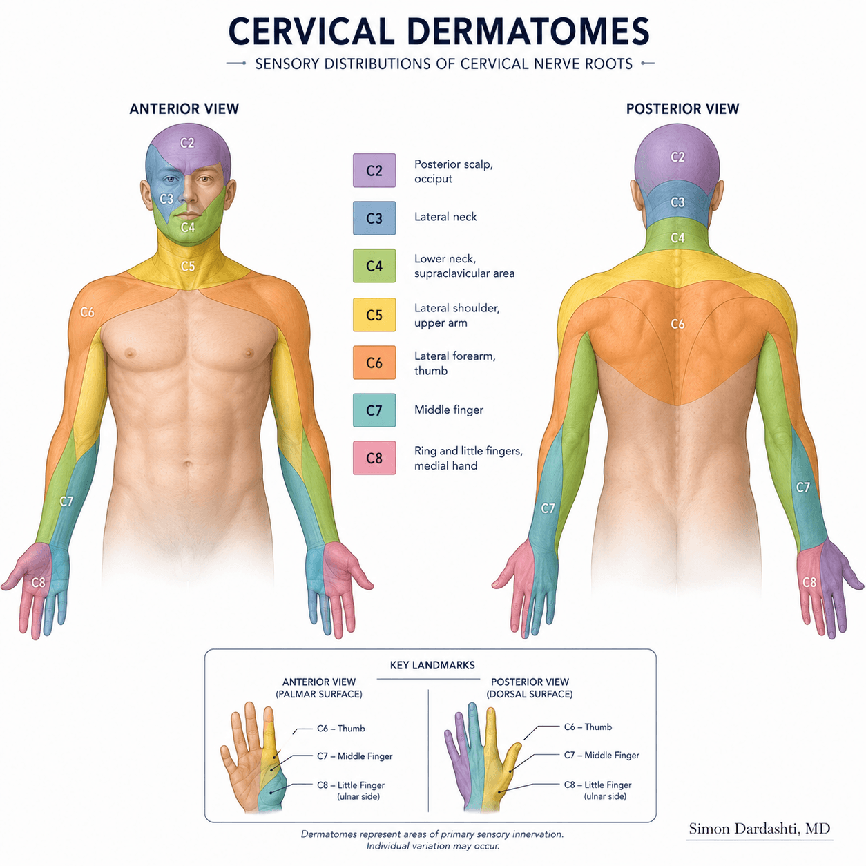 Cervical dermatomes showing C5, C6, C7, and C8 sensory distributions across shoulder, arm, forearm, and hand with clear regional demarcation