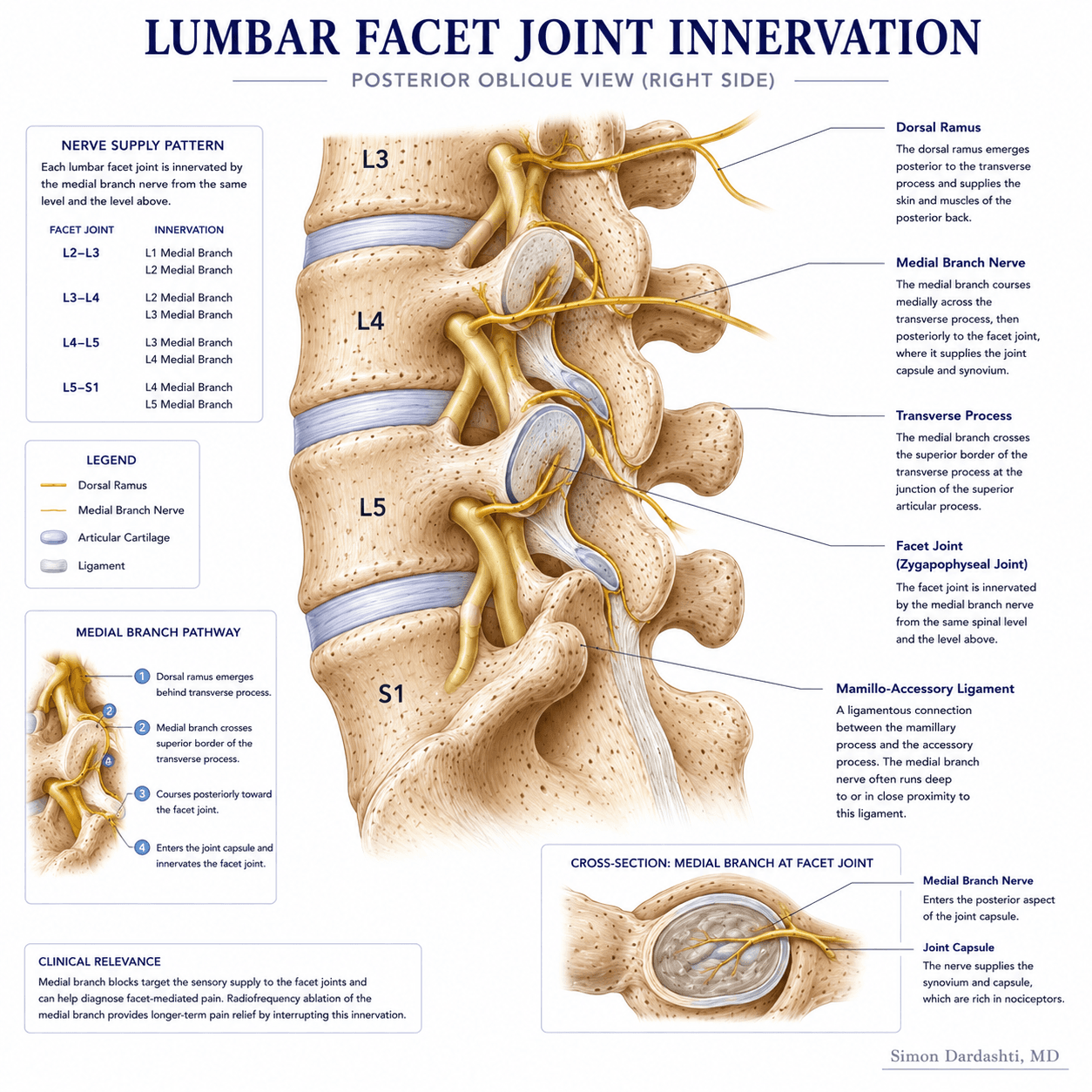 Lumbar facet joint innervation showing medial branches of dorsal rami innervating facet joints from multiple spinal levels, with neural pathway anatomy