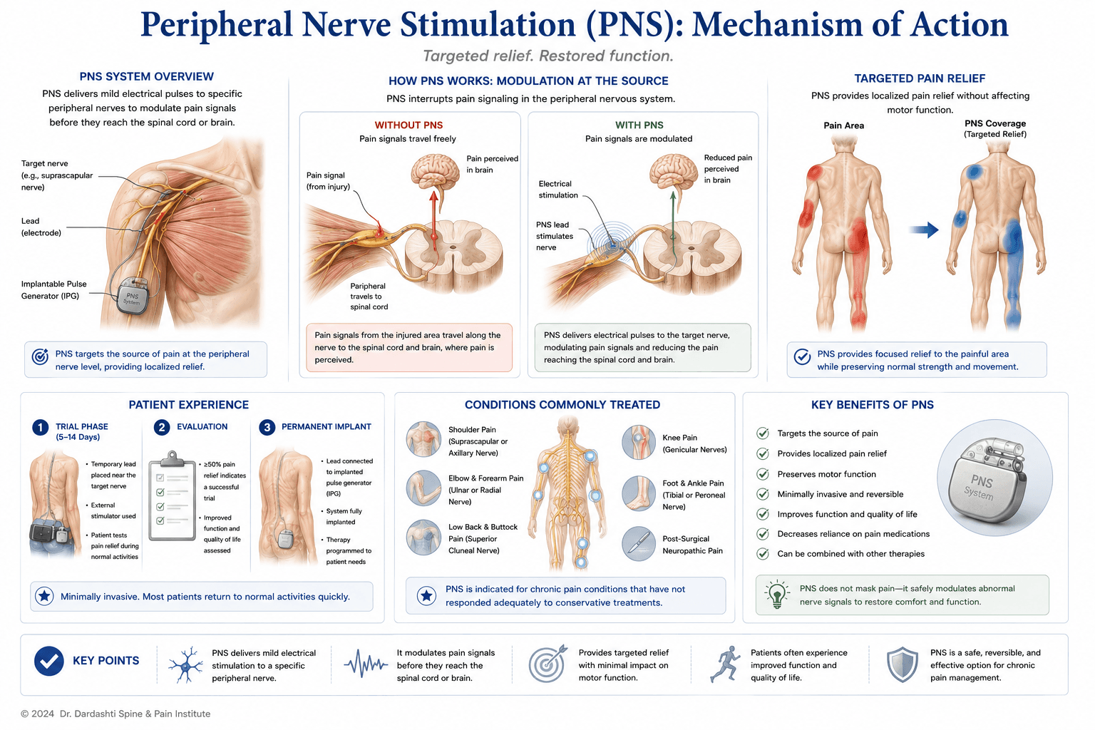 Peripheral nerve stimulation mechanism showing lead placement on target peripheral nerve (femoral, pudendal, other), electrical pulse generation from external or implanted generator, gate control application at peripheral nerve level, and resulting pain reduction in target distribution